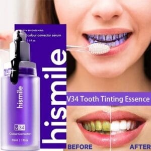 Hismile V34 Teeth Whitening: Deep Stain Removal & Effective Whitening Gel / Serum
