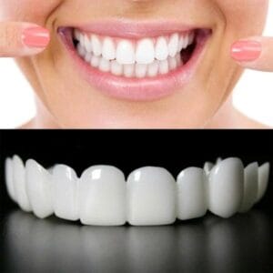 Snap-on Smile For Beautiful Smiles Temporary Comfort Fit Whitening Instant Transformation For Men & Women