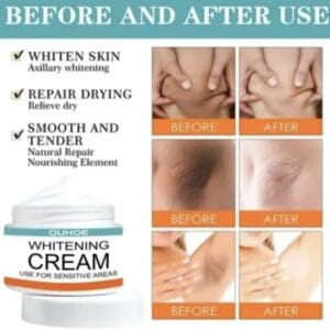 Private Parts , Sensitive Area Whitening Cream – Brighten Underarms, Private Parts & Inner Thighs (30ml)