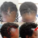 Fast Hair Growth Set Batana Oil Traction Alopecia Hair Mask Anti Break Loss Hair Growth Oil Baldness Treatment Hair Health Care - Image 2