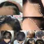Fast Hair Growth Set Batana Oil Traction Alopecia Hair Mask Anti Break Loss Hair Growth Oil Baldness Treatment Hair Health Care - Image 4