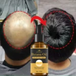 7 Days Fast Batana Oil Hair Growth Serum Anti-loss Hair Regrowth Products Repair Damaged Hair Roots Hair Care For Women Men - Image 3