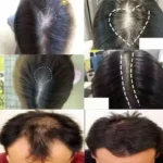 7 Days Fast Batana Oil Hair Growth Serum Anti-loss Hair Regrowth Products Repair Damaged Hair Roots Hair Care For Women Men - Image 4