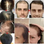 7 Days Fast Batana Oil Hair Growth Serum Anti-loss Hair Regrowth Products Repair Damaged Hair Roots Hair Care For Women Men - Image 2