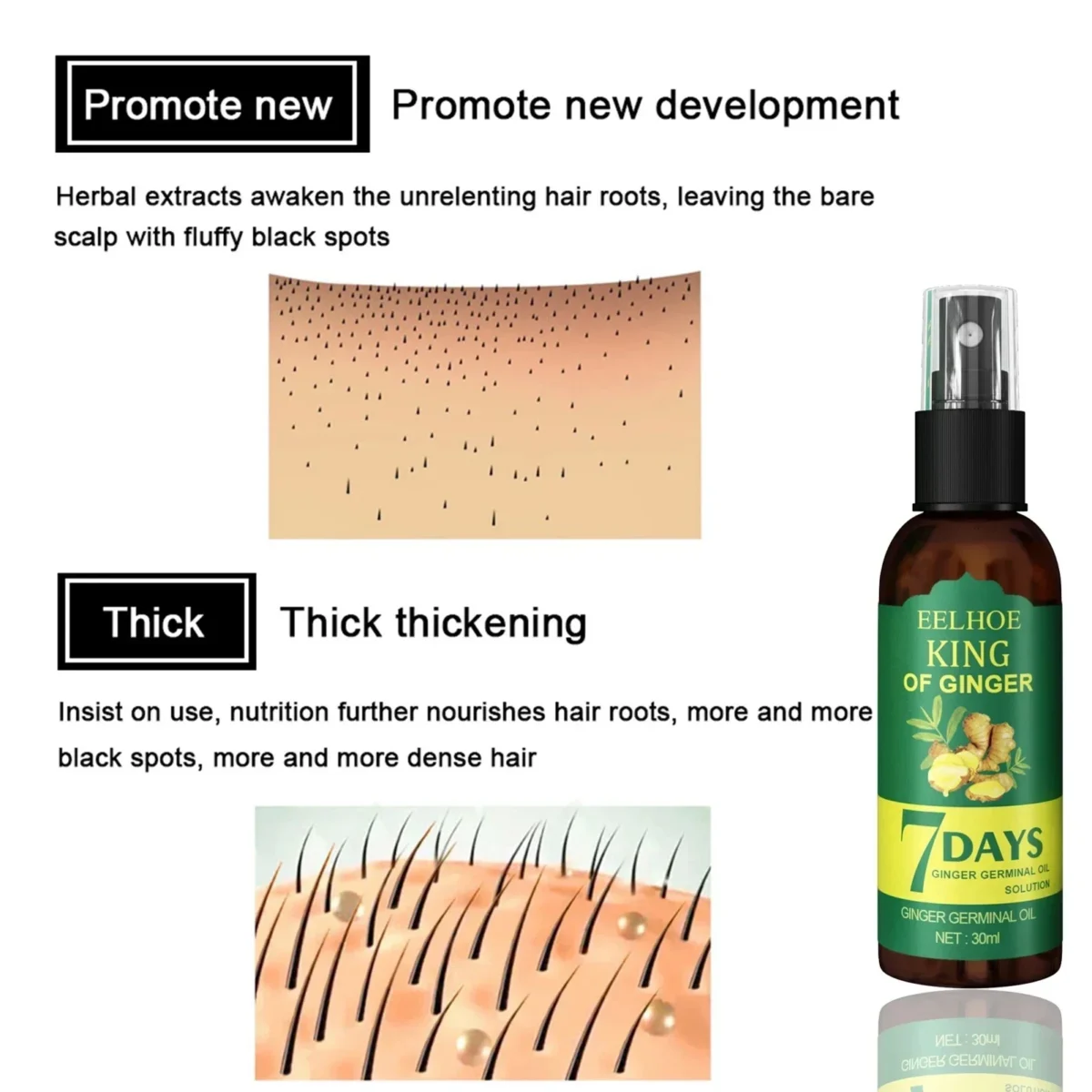 2024 Ginger Hair Growth Serum Sprayer Hair Regrowth s Grow Thicker Longer Hair Accelerate Growth For Men And Women - Image 2
